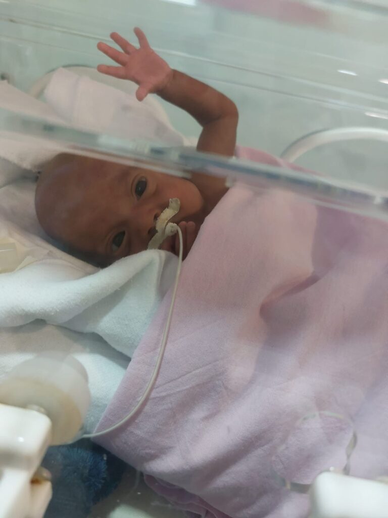 Thuany Boaventura menor bebê prematuro hospital santa rosa